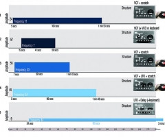 Variations II example of score